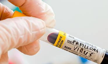 دوره نهفتگی HPV